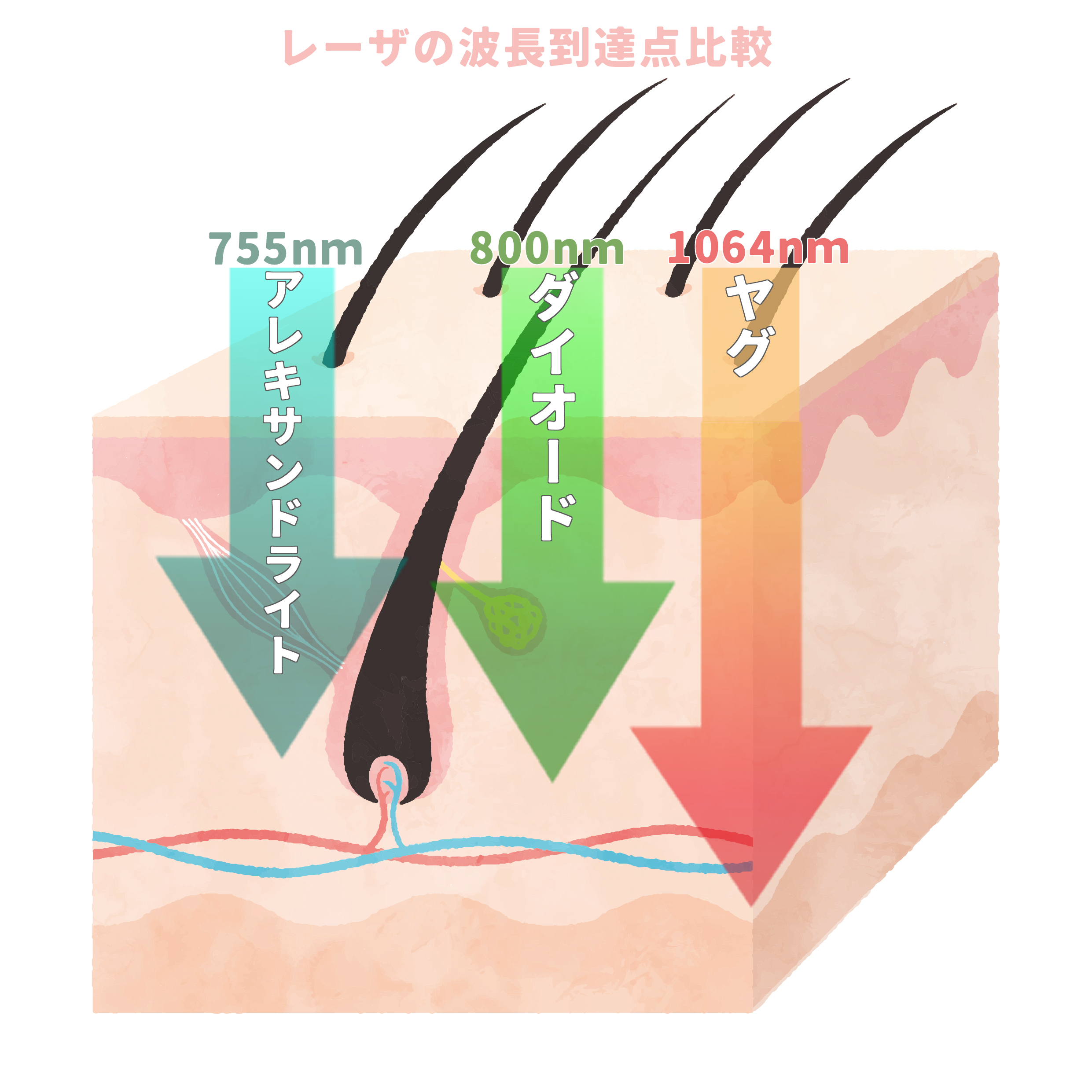 脱毛レーザーの波長比較